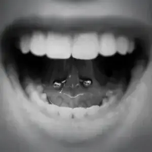 Lingual frenulum piercing area under tongue — illustrating tongue web anatomy and risks