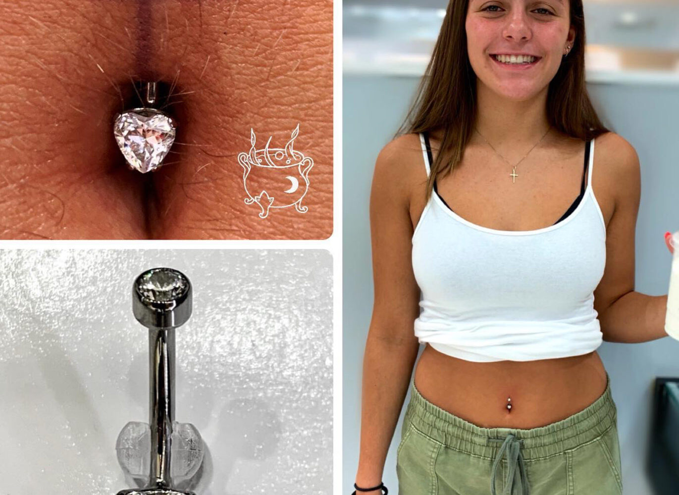 navel anatomy variations and piercing suitability
