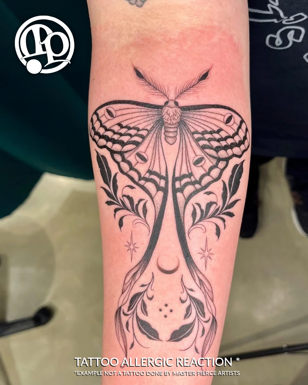 A forearm with a fresh black ink tattoo of a detailed moth and symmetrical ornamental designs; the skin around the tattoo appears red and irritated, possibly from Numbing Creams and Tattoos. Text at the bottom reads, “Tattoo allergic reaction.”.